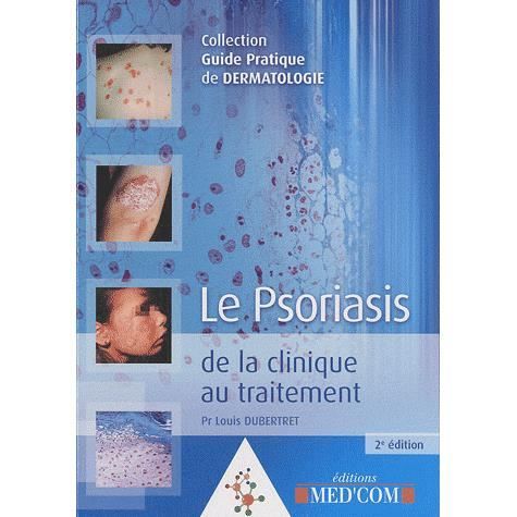 Plus les moyens efficaces du psoriasis