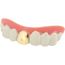 MASQUE - DECOR VISAGE Dentier dent or