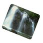 TAPIS DE SOURIS Tapis de souris imprim