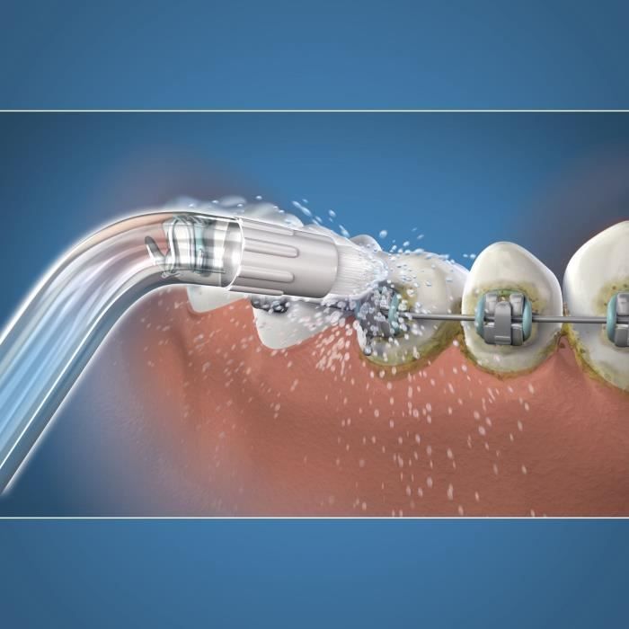 Image secondaire de Embout Hydropulseur - WATERPIK - Orthodontique - Élimine la plaque - Spécial appareils dentaires