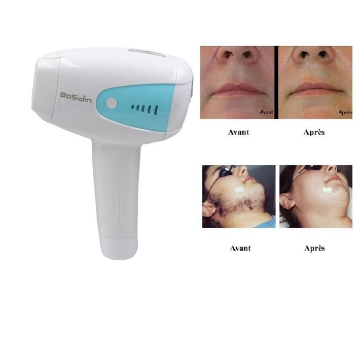L’épilation laser Epilation Laser Visage et corp Achat / Vente lumiere pulsee laser L’épilation laser Epilation Laser Visage et corp Achat / Vente lumiere pulsee laser