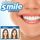 SHOP STORY - Dent de Remplacement Réutilisable et